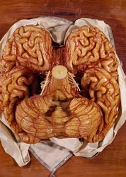 Modèle de cerveau (cire)